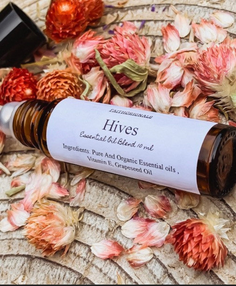 Hives Essential Oil Roller Blend 10ml