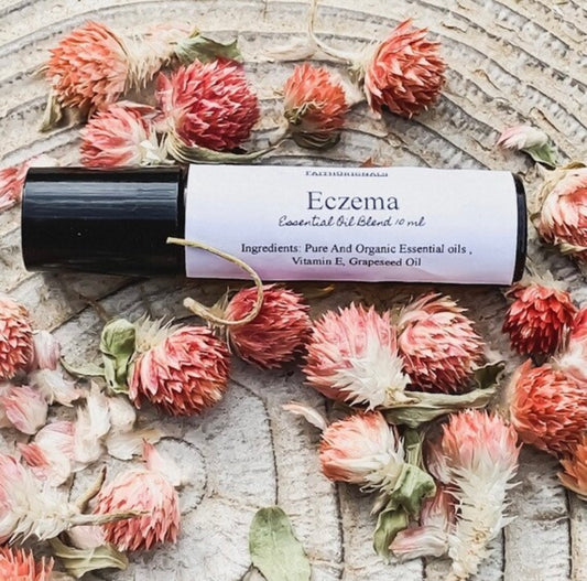 Eczema Essential Oil Roller Blend 10ml